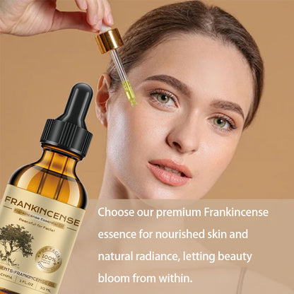 30ml *2 Aceite Esencial de Mastic con Rosa Hidratante y para Masaje de la Piel