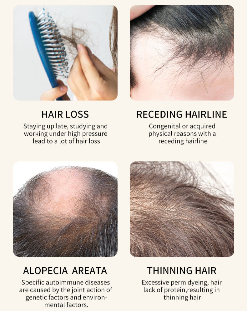 Illustrations and text explaining hair loss, receding hairline, alopecia areata, and thinning hair.