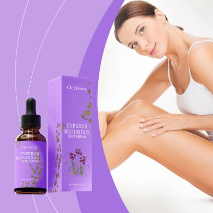 Cyperus Rotundus Serum Hair Growth Inhibitor Soothing Moisturizing Depilatory Refreshing Slowing Reduction Body Hair Growing Oil